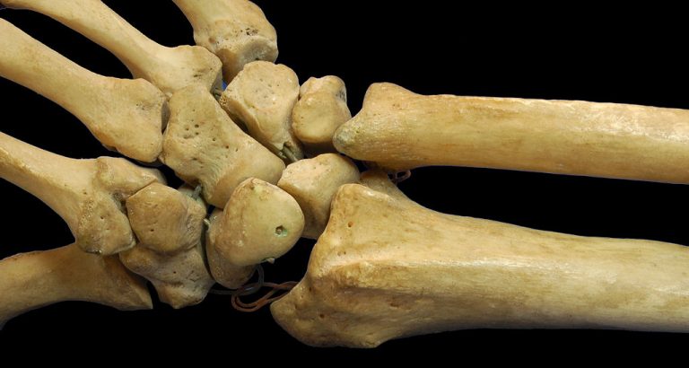 5 Examples of Short Bones 5 Examples of Short Bones