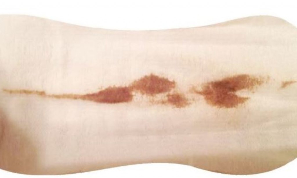 Virginal Discharge Brown