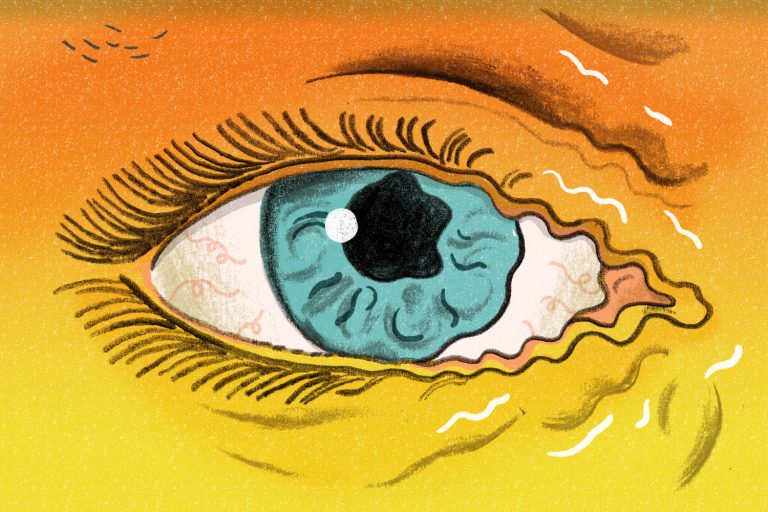 Why is my Eye Twitchy? Meaning, 2 causes and remedy Why is my Eye Twitchy? Meaning, 2 causes and remedy