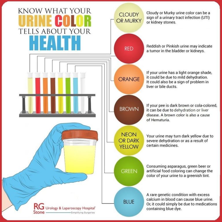 Why is my Urine red? 3 urine colours you need to know