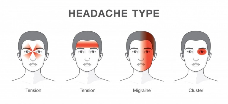 Headaches and Migraines, any difference?