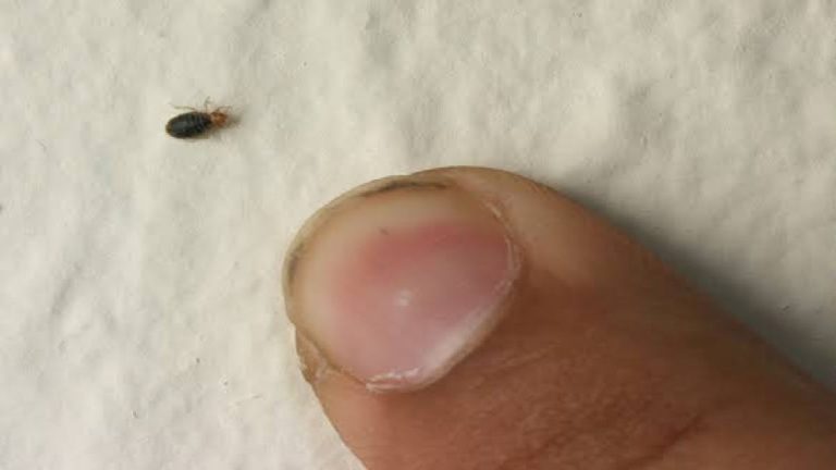 Bed bugs: 5 home remedies for dealing with bed bugs