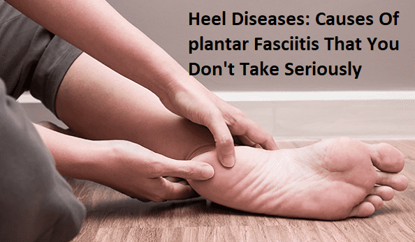 Heel Diseases - Causes Of Plantar Fasciitis That You Don't Take Seriously