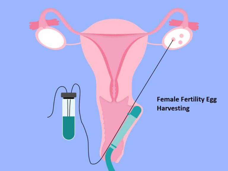 Female Fertility Egg Harvesting – Meaning, Process, Cost, And 7 Disadvantages Of Female Egg Harvesting