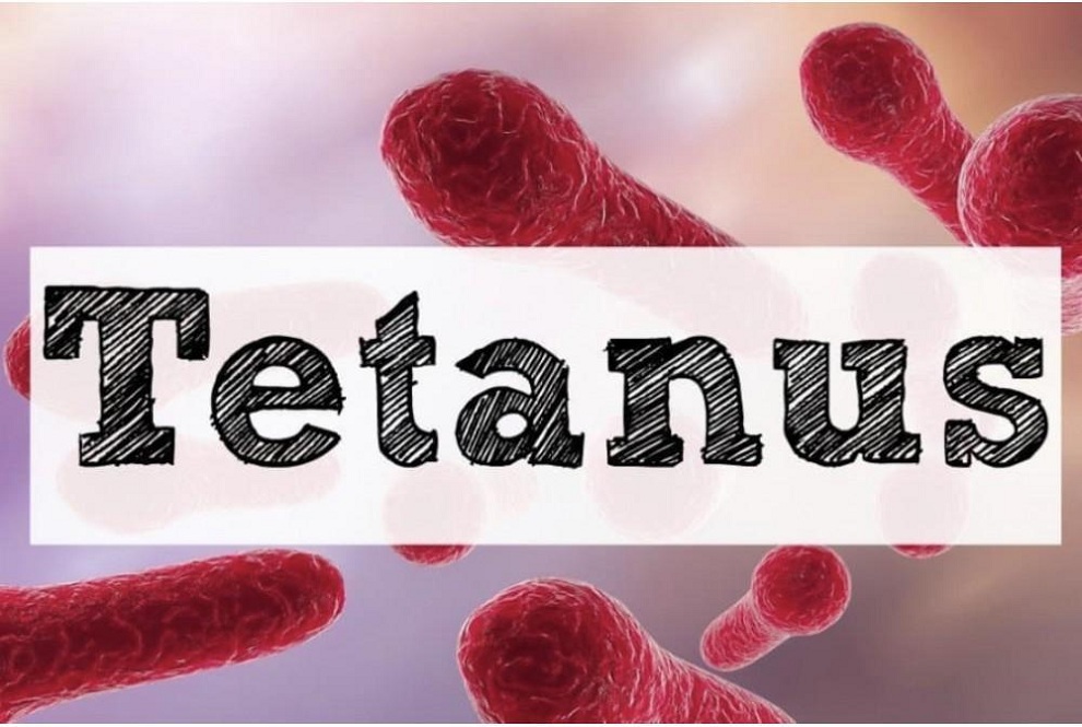 Tetanus: Causes, Symptoms, Complications, Prevention and Treatment